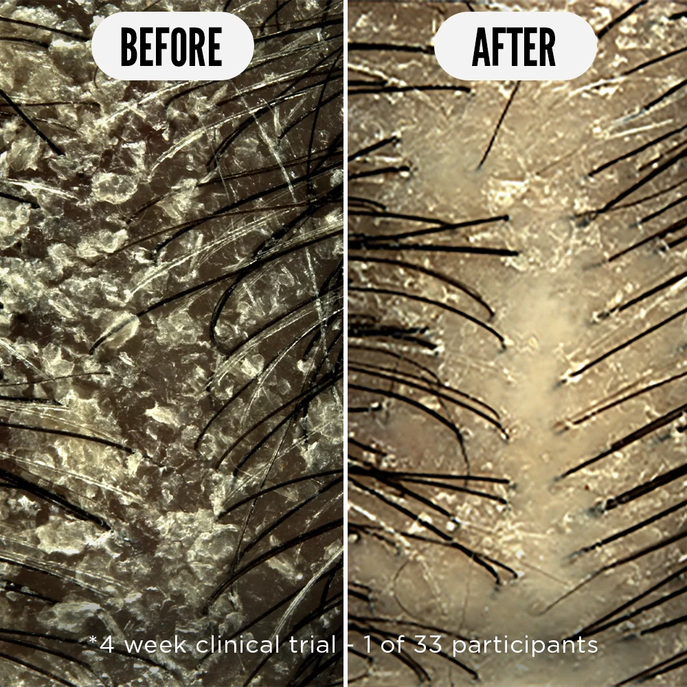 Care Taker Scalp Tonic - Image 4